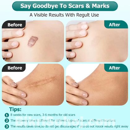 Jaysuing Advanced Scar Gel